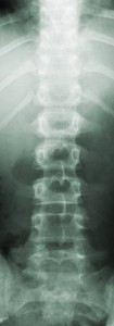 Explication détaillée de la colonne vertebrale pour mieux gérer son mal de dos
