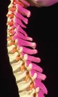 Quels types de maladie de la colonne vertebrale existent